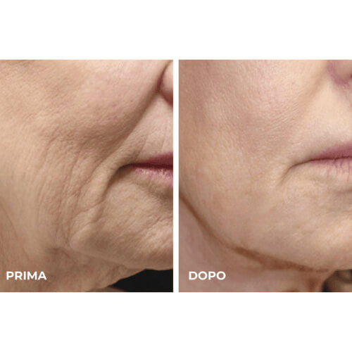 Prima-e-dopo-massaggiatore-6.jpg